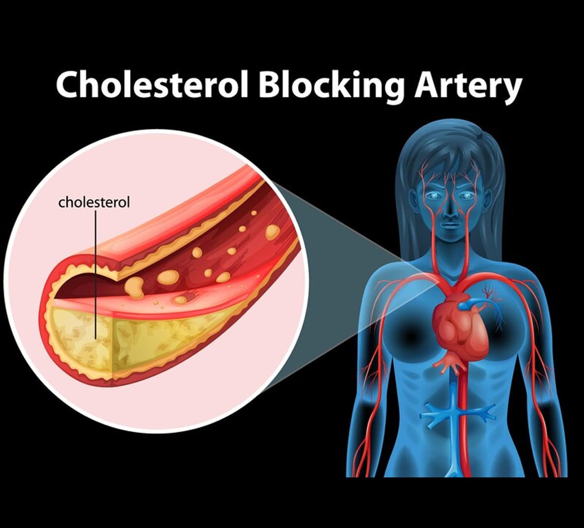 These 5 foods increase bad cholesterol in the body instantly