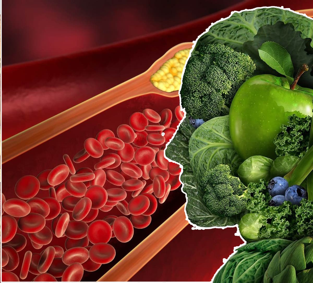 Green Superfoods for Lowering Cholesterol and Preventing Stroke